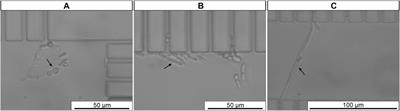 Microfluidics combined with fluorescence in situ hybridization (FISH) for Candida spp. detection